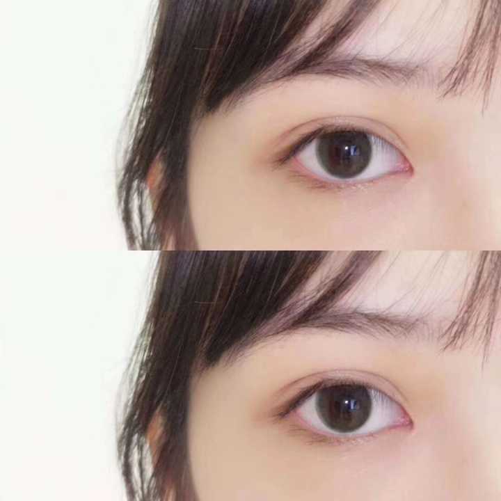 佛山新增1例人感染H7N9广东全省共报告70例:开云电竞(图1) 开云电竞